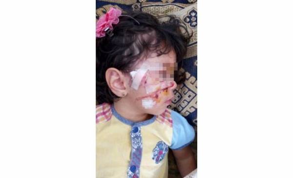 إربد ..كلب ضال يسحب فتاة ويشوهها