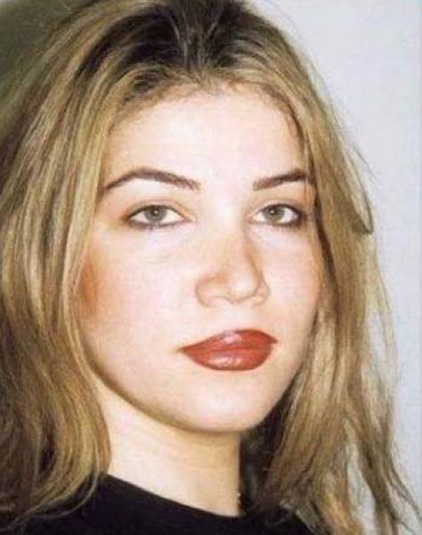 قبل مشرط أطباء التجميل .. هذه الفتاة أصبحت نجمة لبنانية شهيرة