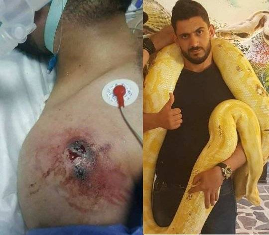 لدغة أفعى قاضية ..الراعييصارع الحياة وفسيبوكيون ينتفضون لأجله  صور