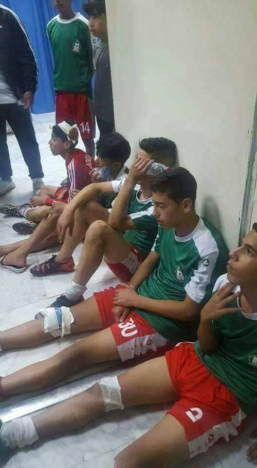 بالصور: اصابات لاعبي نادي الوحدات بعد الإعتداء على حافلتهم