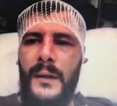 الأردني المعتدي عليه في البحرين يكشف سبب ضربه