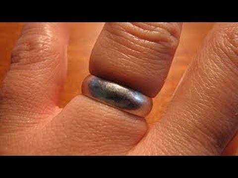 مدير المدرسة يفزع والحجايا:الخاتمسبب دخول المعلم المستشفى