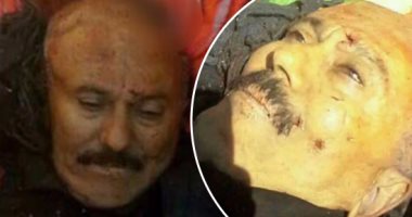 طبيب شرعي يمني يكشف أسرار خطيرة حول جثة على عبدالله صالح