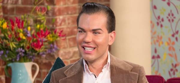 هكذا أصبح شكل «رجل الدمية» بعد آخر عملية تجميل.. المنظر لا يصدق!