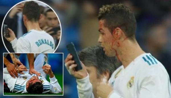 بالفيديو.. كريستيانو رونالدو ينزف دما!