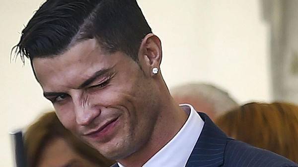 بعد تعافيه من إصابة الوجه.. رونالدو: ما زلت وسيما