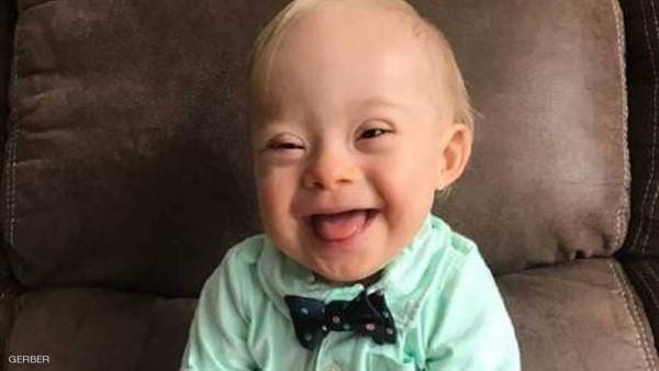 شركة تختار رضيعا بمتلازمة داون متحدثا باسمها