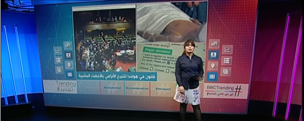 قانونٌ غير مسبوق في #هولندا يقضي بسقوط الملكية الذاتية للأعضاء البشرية بعد الوفاة