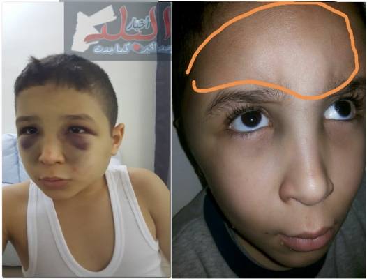 تأجيل النظر في قضية الاعتداء على طالب سعودي في مركز للاحتياجات الخاصة