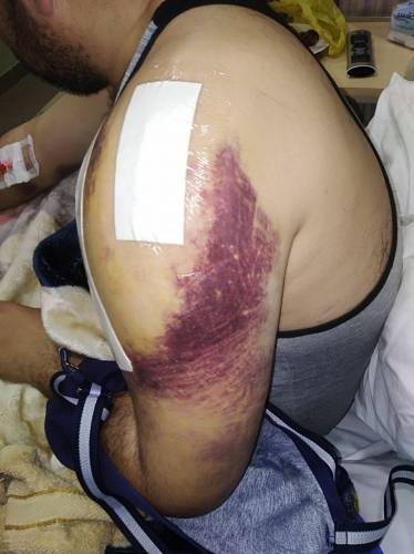 شعبان تعرض لصعقة كهربائية خلال عمله وتقارير طبية تؤكد ذلك..وإدارة الشركة تنفي وتوضح