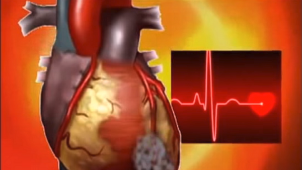 لأول مرة.. العلماء يتحكمون بالقلب باستخدام الليزر!