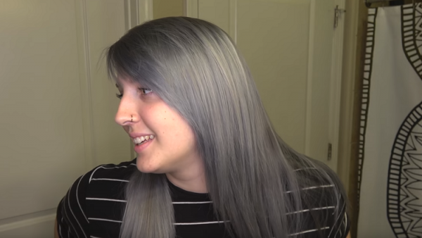 حالة نادرة.. طفلة شابت بعمر 7 سنوات (صورة)