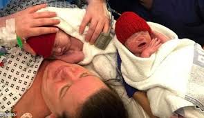 ولادة نادرة تحدث مرّة بين كل 500 مليون سيدة