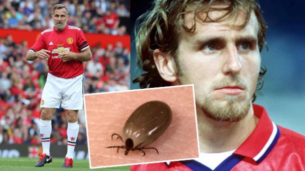 حشرة كادت أن تقتل نجم مانشستر يونايتد!