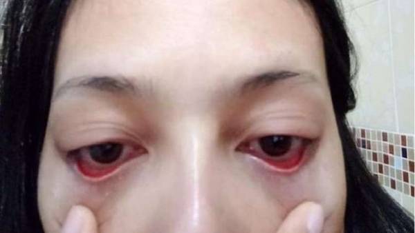 تحذير.. صالون تجميل يشوه امرأة!