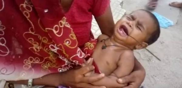 بالفيديو| لقطات مرعبة لرضيعة اخترق فمها سيخ حديد