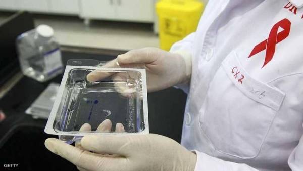 منتج طبيعي يحدث ثورة في علاج الإيدز