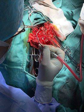 فريق طبي يجري عملية ناجحة لشاب تعرض لضربة صاروخ (صور)