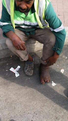 بالصور..عامل وطن يعمل بقدم دامية ومطالبات من رئيس بلدية اربد نجدته