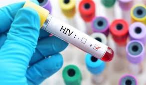 8 خرافات حول الإيدز لا تصدقها