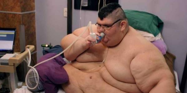 أثقل رجل في العالم بغرفة العمليات.. والهدف رقم قياسي جديد