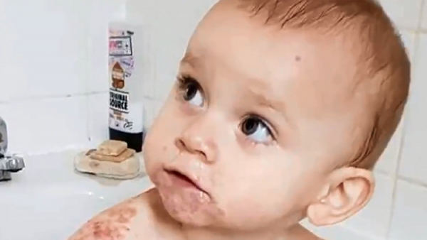 تحذيرات طبية.. قبلة على فم رضيعة كادت أن تقتلها