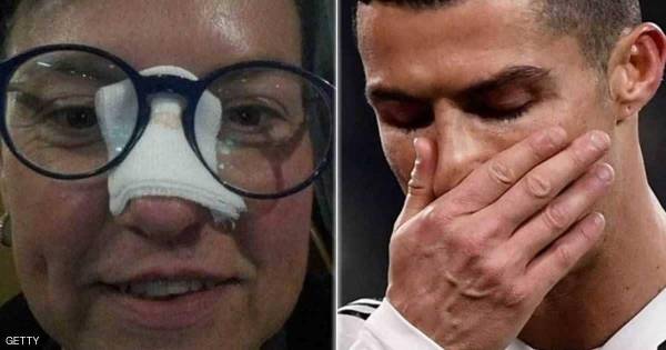 بعد أن كسر أنفها.. رونالدو يجبر خاطر الضحية