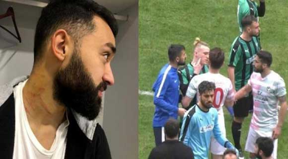 لاعب تركي يعتدي على لاعبي الخصم بآلة حادة (فيديو)