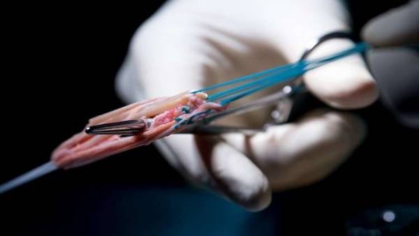 وفاة مليونير الألماس أثناء عملية لتكبير عضوه التناسلي!