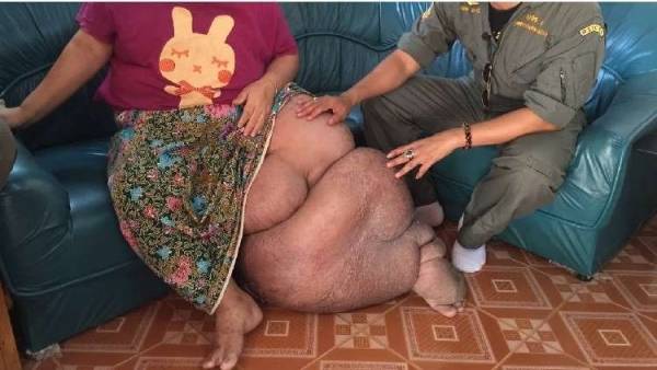 مواطن باكستاني يصلي من أجل بتر ساقه