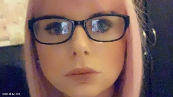 صورة مخيفة لفتاة بعد عملية تجميل لنفخ الشفاه