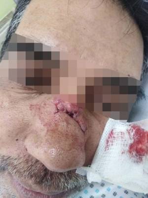 اعتداءٌ على عاملٍ وافد من قبل فارض أتاوات وحالته العامة متوسطة