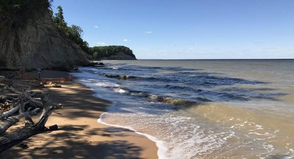 بكتيريا آكلة اللحوم تثير الذعر في أمريكا