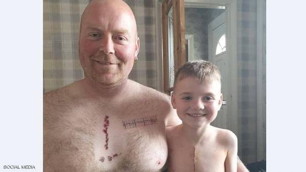 أب يرسم وشم الغرز الجراحية تعاطفا مع ابنه المريض