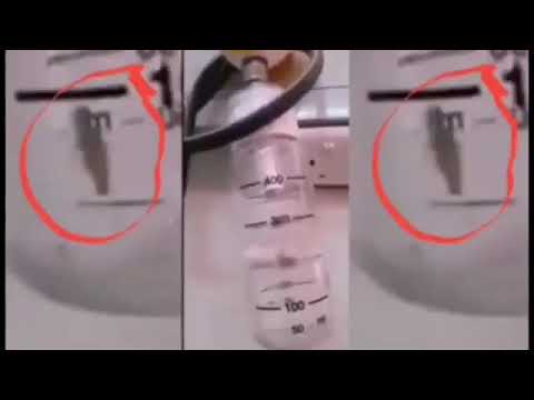 “صرصور” داخل جهاز تنفس بمستشفى حكومي ..والصحة تحقق (فيديو)