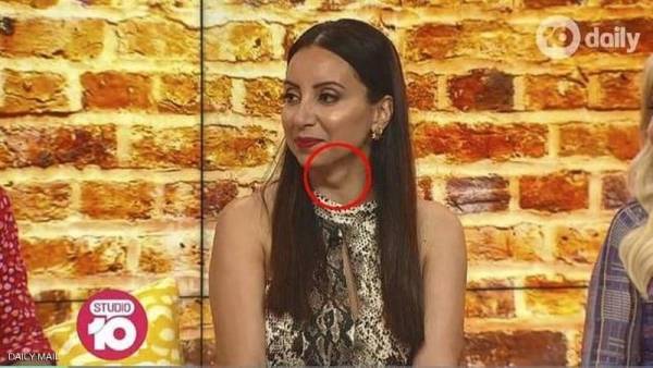 لقاء تلفزيوني يكشف كارثة في رقبة المذيعة