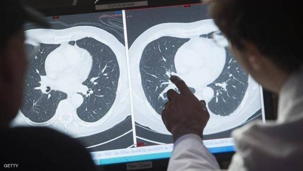 اختراق علمي.. فيروس سحري لقتل خلايا السرطان