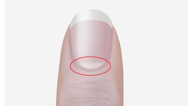 على ماذا يدل هلال الأظافر؟