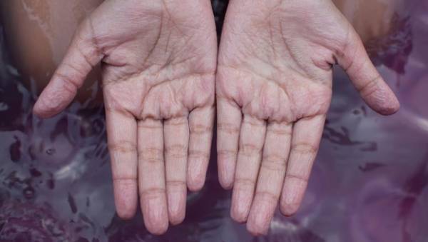 ما سبب تجعد الأصابع؟