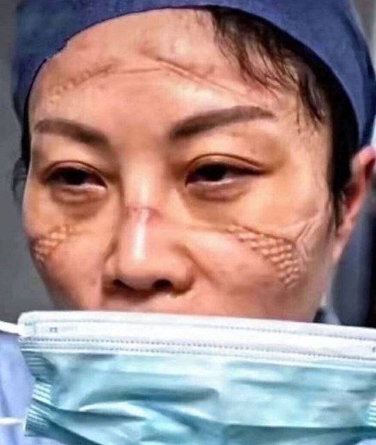 صادم.. هذه حالة الأطباء في الصين بسبب كورونا (صور)