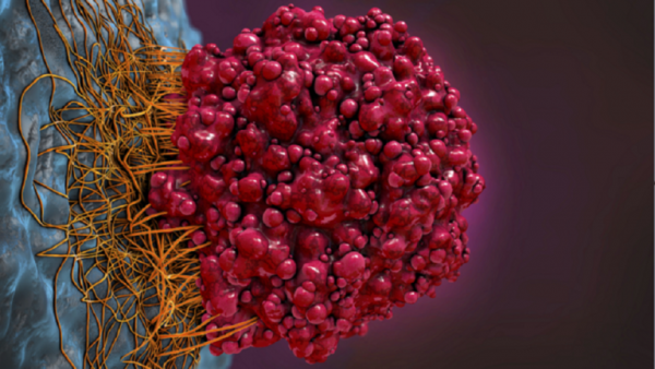 التعرق ليلا قد يكون علامة تحذيرية لنوع من السرطان!