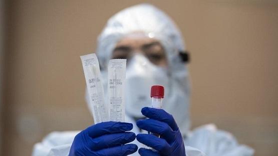 إصابة كورونا جديدة في عجلون