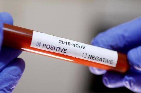 سحب 300 عينة عشوائية لفحص كورونا بالكرك