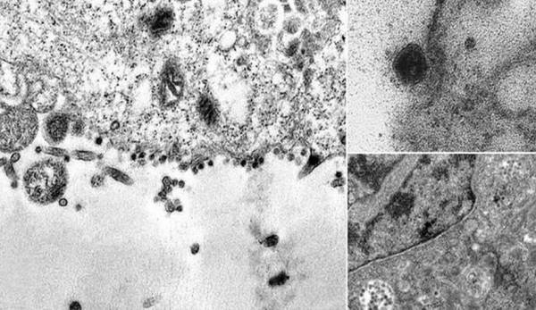 شاهد بالصور.. إلتقاط لحظة إصابة فيروس كورونا لخلية سليمة