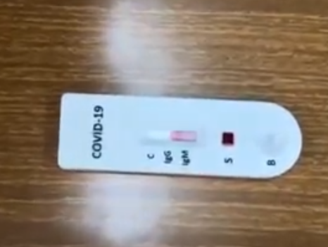 شرائح تختصر مدة فحص كورونا بالأردن