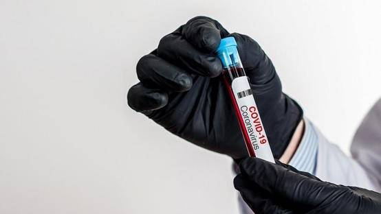 سحب 500 عينة كورونا عشوائية في العقبة