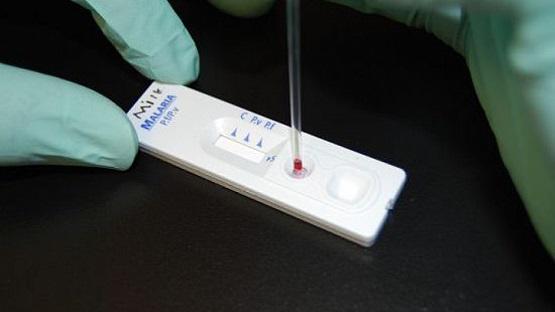 الأردن: فحص تفاعل البلمرة المتخصص هو المعتمد النهائي لإثبات الإصابة بكورونا