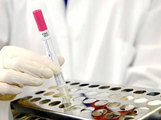 البلقاء: نتائج 700 عينة عشوائية سلبية