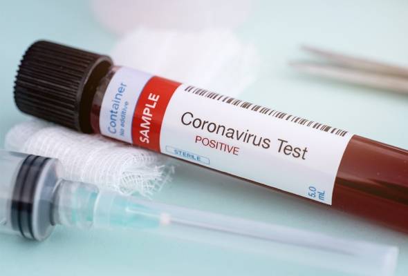 إربد: إصابة جديدة بكورونا لممرض عائد من عمان