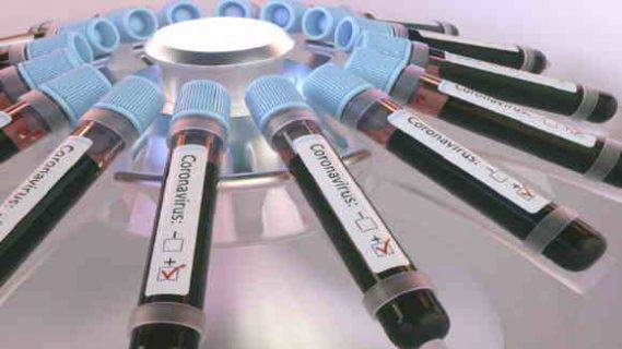 علماء يحذرون من علامة جديدة على احتمال الإصابة بفيروس كورونا!